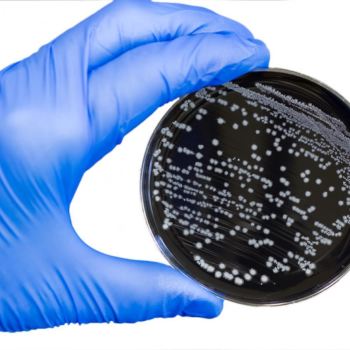 ničenie mikroorganizmov dezinfekcia